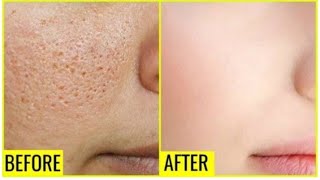 Glowing Skin At Home | Glowing Skin Face Pack | Skincare For Glowing Skin
