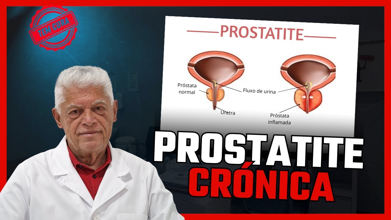 PROSTATITE CRÓNICA TEM CURA