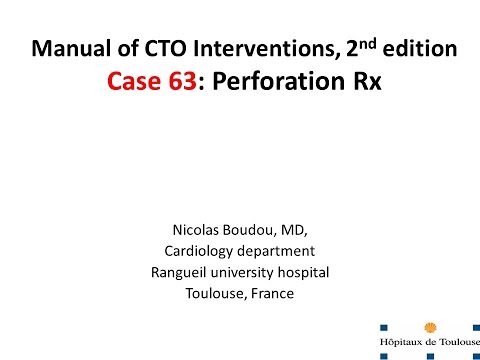 Case 63: Manual of CTO Interventions - Large vessel perforation
