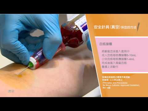 採血管順序口訣