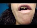 ASMR UVULA Girl UPCLOSE MOUTH Eating Halloween KITKAT CHOCOLATE CANDY BAR Shorts