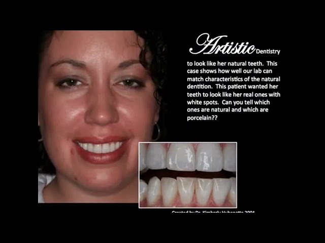 testimonia - Artistic Porcelain Crowns