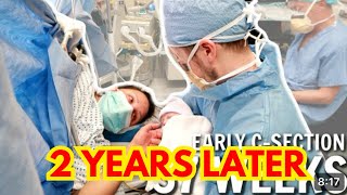 REPEAT C-SECTION UPDATE | 2 years postpartum update