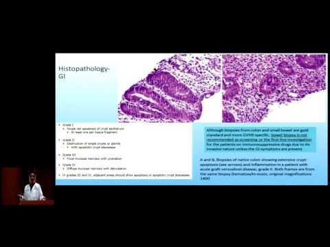 Pathophysiology of Graft-Versus-Host Disease