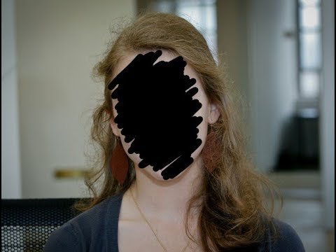 Życie seksualne po operacji na penisa Który lek jest najlepszy do powiększania penisa