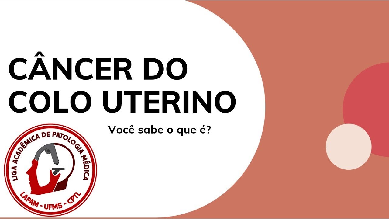 Câncer do colo do útero/ Câncer cervical