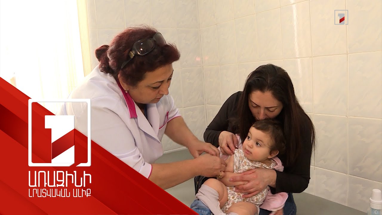 Կարմրուկի տարածվածությամբ ՀՀ-ն 8-րդն է. 6-11 ամսականների պատվաստումը՝ համաճարակաբանական ցուցումով