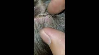 Huge SCAB ON HEAD part 2