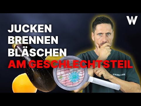 Genitalbereich: Jucken, brennen, Bläschen im Intimbereich - Ursachen, Symptome und Lösungen!