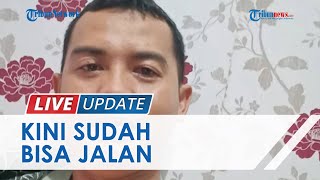 Kondisi Terkini Satpam yang Tersambar Petir di Cilincing, Alami Luka Bakar hingga 65 Persen