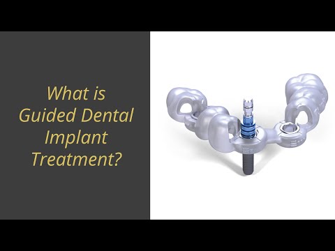 What is Guided Dental Implant Surgery?