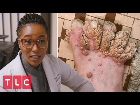 Sebastian's Mysterious Skin Condition | My Feet Are Killing Me