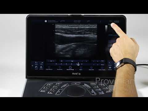 GE Vivid iq Training Part 2: 2D Imaging