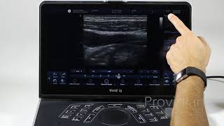GE Vivid iq Training Part 2: 2D Imaging