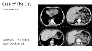 Case of the Day - 109 - 2025 09 25 - The Bright Liver on Chest CT