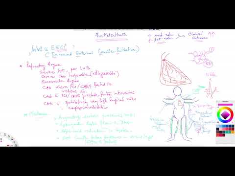 ^MuniSTHealth - #244 What Is Enhanced External Counter-Pulsation (EECP)?