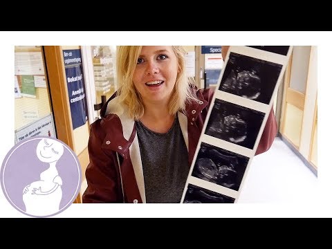 Det är en riktig sprallis! - Jennie-Lie & Hampus v.21 (fd.20)