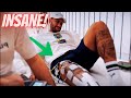 Neymar's INSANE ACL Surgery Rehab! [REACTION]