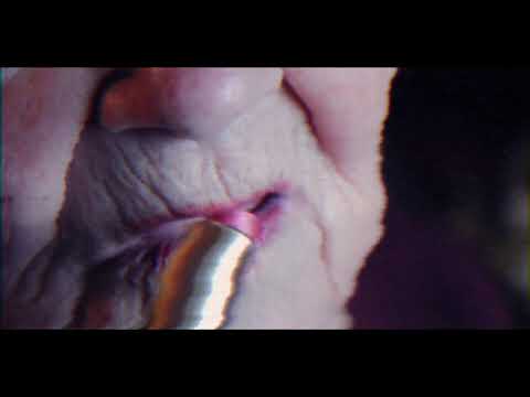 Trailer | Under the Dress | Aleksandr M. Vinogradov