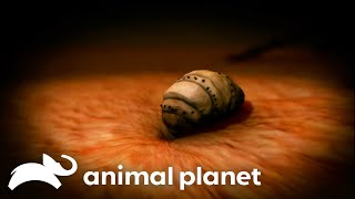 Man Has MAGGOTS Crawling Around His Head | Monsters Inside Me | Animal Planet