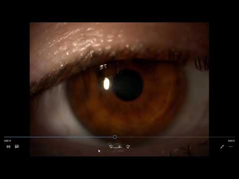 3  Manejo de las adaptaciones de lentes de contacto esféricas y tóricas  Casos reales con vídeos