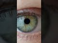 Human Eye Dilation #shorts #eyes