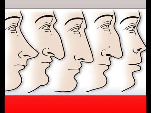 Forma del naso. Non solo genetica, ma anche adattamento al clima