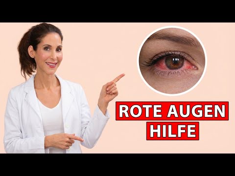 Get rid of red & dry eyes - It really works!