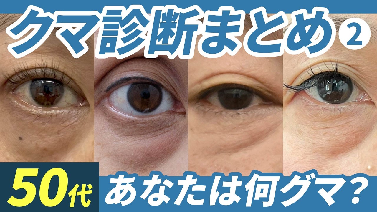 【50代必見】もう老け顔に悩まない！目の下のたるみ・クマ診断Part2｜複数のプロが教える「若返り」の正解とは？#クマ取り  #目の下のクマ #裏ハムラ #脂肪注入#美容整形#湘南美容クリニック