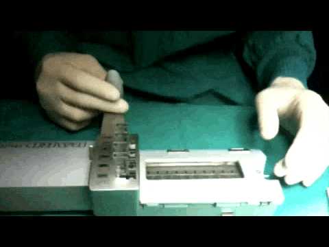 Trattamento delle nuove tecniche di prostatite Alfa bloccanti prostata