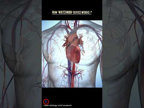 How the WATCHMAN device works ? #cardiology #heart
