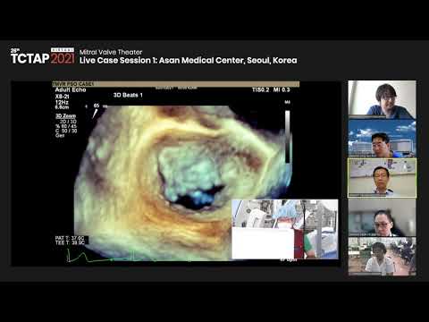 [TCTAP 2021 Virtual]  Mitral Valve Theater - Live Case Session 1
