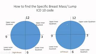 ICD 10 Coding Guide for Breast Mass/Lump (N63 series)