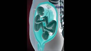 Download lagu Twins struggles inside the Womb for supremacy (3D Animation) mp3 Download lagu Twins struggles inside the Womb for supremacy (3D Animation) mp3
