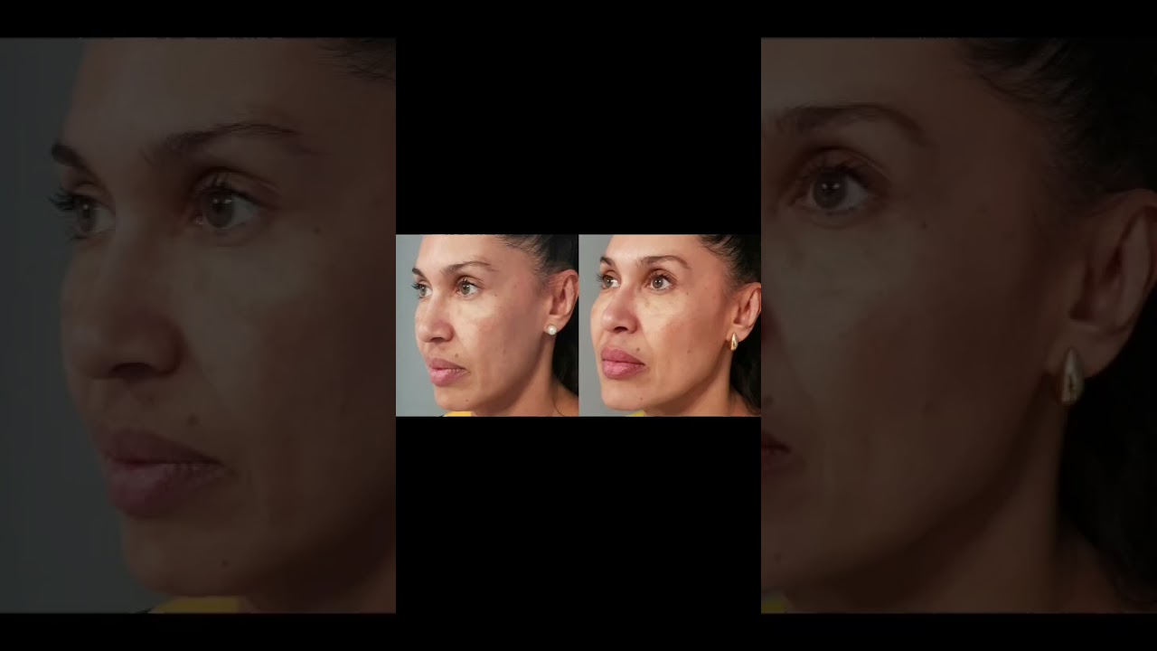 Rosalba Herrero Zerpa-635