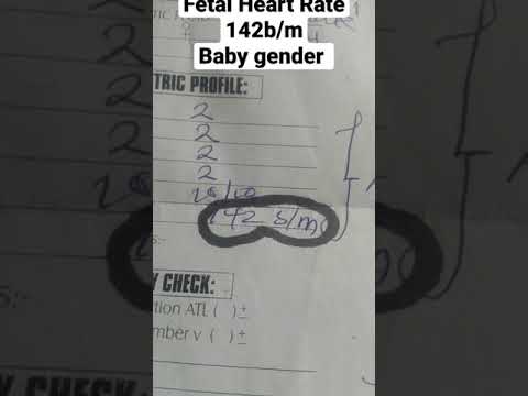 Fhr 142 b/m Baby boy or girl(Ultrasound scan Report)