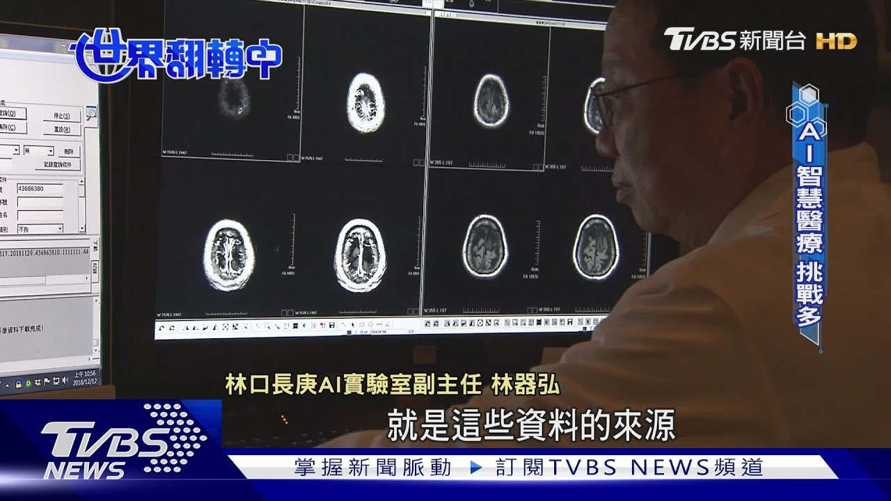 AI無所不在 套用於醫療場域 挑戰有哪些?