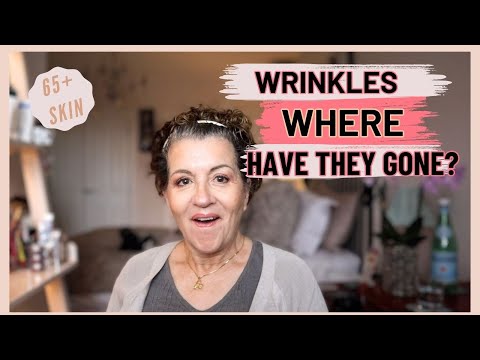 NON-SURGICAL FACELIFT// My 8-Week Transformation!?