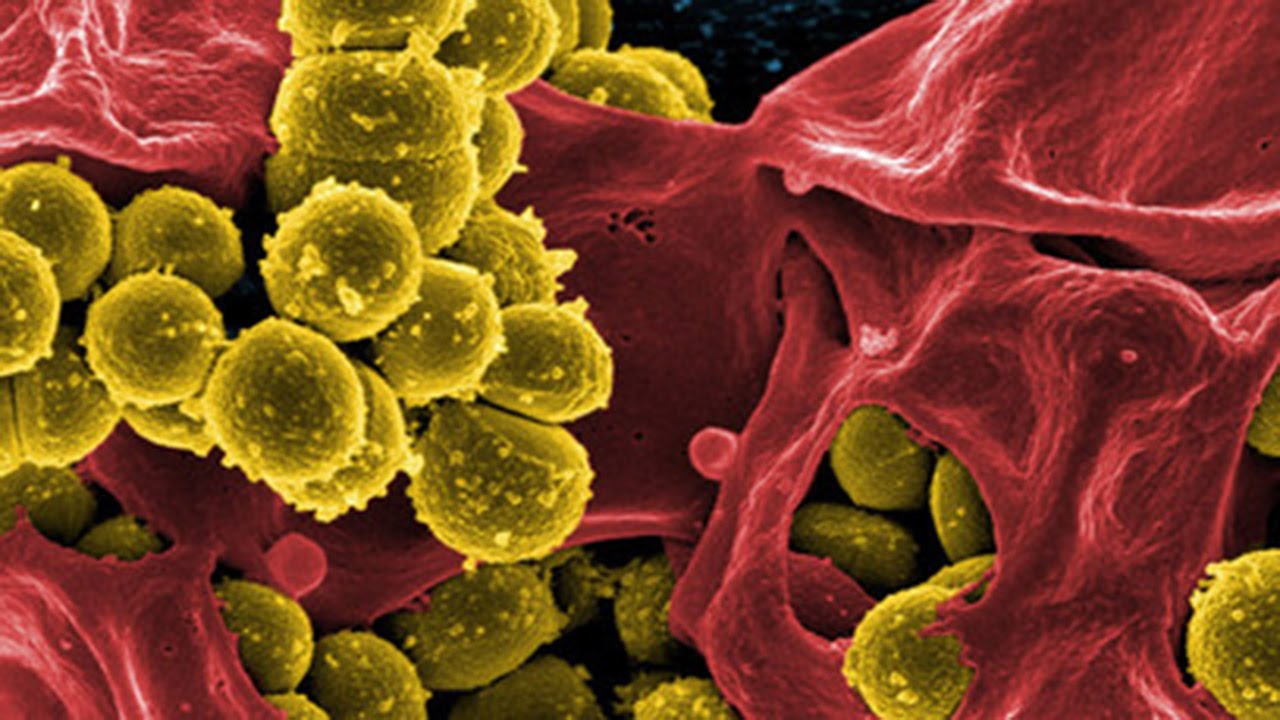 Antimicrobial Stewardship: Managing Antibiotic Resistance - free online course at FutureLearn.com