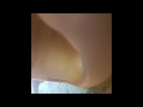 Fall Heroin - Roky Erickson x Lou Reed x Brock Winthrop Mashup