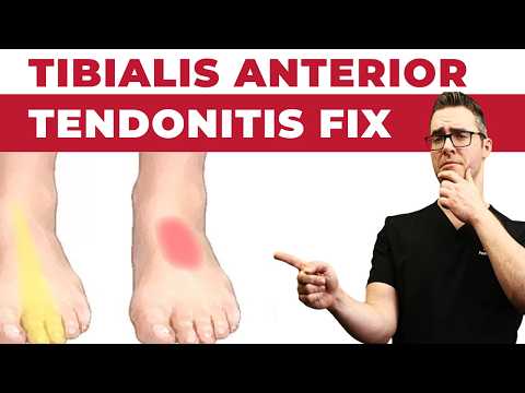Heel Spurs Plantar Fasciitis BEST Home Treatment 2022