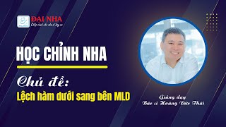[Học chỉnh nha] - Lệch hàm dưới sang bên MLD. Giảng viên bác sĩ Hoàng Đức Thái.