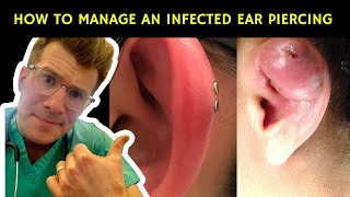 How to recognise, manage and treat an infected ear piercing | Doctor O