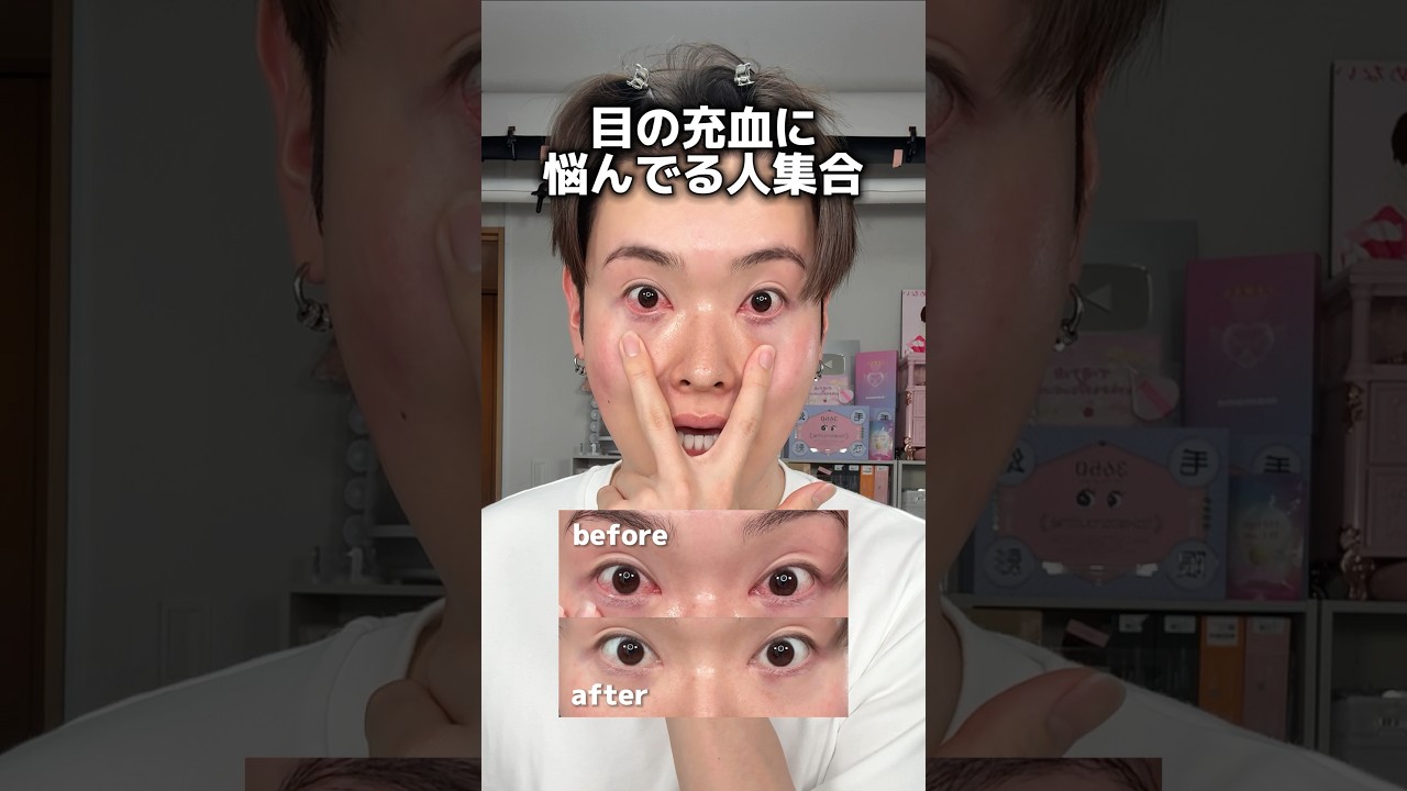 目の充血、解決させてください！！！！