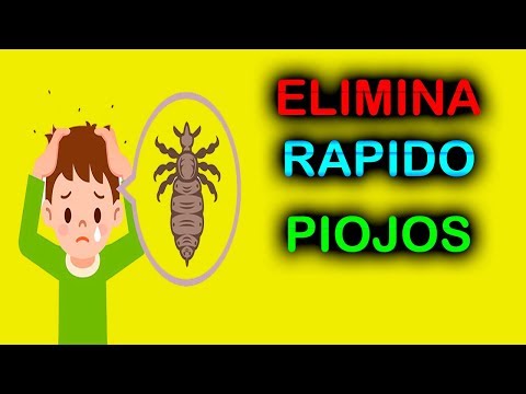 MP3 LOS PIOJOS SCARICARE