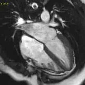 Not for the Faint Hearted...