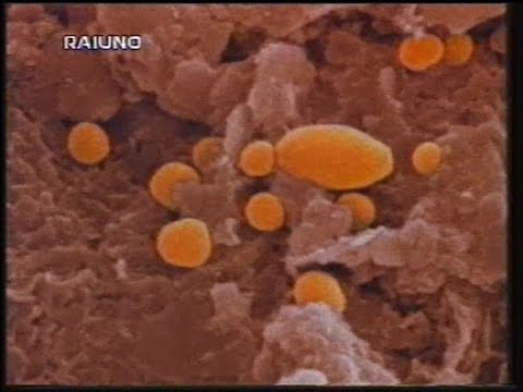 Aumento del pene dopo lintervento chirurgico Cosa fare se un pene piccolo