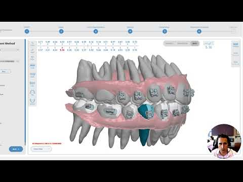 DIBS AI #2: Case set up tutorial, skeletal vs soft tissue cant, skeletal expansion, occlusion