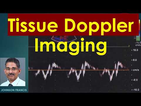 Tissue Doppler Imaging