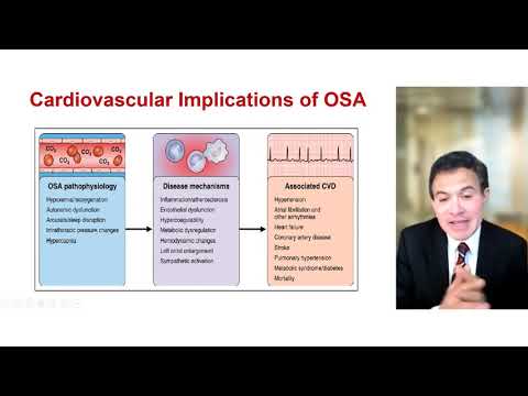 State-of-the-Art Sleep Apnea and Cardiovascular Disease